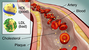Cholesterol in the Blood